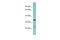 Mannan Binding Lectin Serine Peptidase 2 antibody, NBP1-58986, Novus Biologicals, Western Blot image 