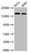 Cyclin Dependent Kinase 12 antibody, LS-C673839, Lifespan Biosciences, Western Blot image 