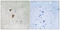 Heat Shock Transcription Factor 1 antibody, LS-C199082, Lifespan Biosciences, Immunohistochemistry paraffin image 