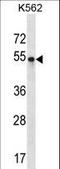 POU Class 3 Homeobox 2 antibody, LS-C163876, Lifespan Biosciences, Western Blot image 