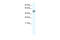 Egl-9 Family Hypoxia Inducible Factor 2 antibody, 28-104, ProSci, Western Blot image 