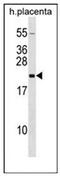 Growth Hormone 2 antibody, AP51834PU-N, Origene, Western Blot image 