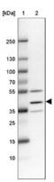 Transmembrane Protein 116 antibody, NBP1-81881, Novus Biologicals, Western Blot image 