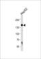 Hypoxia Up-Regulated 1 antibody, 62-818, ProSci, Western Blot image 
