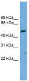 rSec8 antibody, TA336017, Origene, Western Blot image 