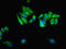 Ubiquitin Specific Peptidase 14 antibody, LS-C317696, Lifespan Biosciences, Immunofluorescence image 