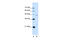 Flap Structure-Specific Endonuclease 1 antibody, 30-157, ProSci, Western Blot image 