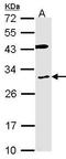 Cytochrome B Reductase 1 antibody, GTX104793, GeneTex, Western Blot image 