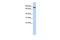 Adenosine Deaminase RNA Specific B2 (Inactive) antibody, GTX47280, GeneTex, Western Blot image 