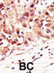 SUMO Specific Peptidase 5 antibody, abx026768, Abbexa, Immunohistochemistry paraffin image 