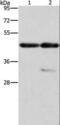 Actin Alpha 1, Skeletal Muscle antibody, LS-C401229, Lifespan Biosciences, Western Blot image 