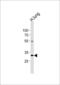 Colony Stimulating Factor 2 Receptor Alpha Subunit antibody, 60-577, ProSci, Western Blot image 