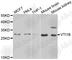 Vesicle Transport Through Interaction With T-SNAREs 1B antibody, A7062, ABclonal Technology, Western Blot image 