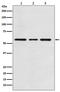Activin A Receptor Like Type 1 antibody, M01468-1, Boster Biological Technology, Western Blot image 