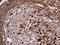 Methyltransferase Like 7A antibody, LS-C792258, Lifespan Biosciences, Immunohistochemistry paraffin image 