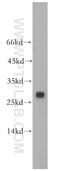 Carboxymethylenebutenolidase Homolog antibody, 17409-1-AP, Proteintech Group, Western Blot image 