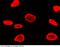 Ribosomal Protein S6 Kinase A2 antibody, 101059-T10, Sino Biological, Immunohistochemistry paraffin image 