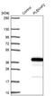 Pleckstrin Homology And FYVE Domain Containing 2 antibody, NBP1-82265, Novus Biologicals, Western Blot image 