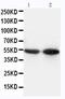 CD14 antibody, PA5-78959, Invitrogen Antibodies, Western Blot image 