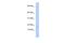 Iron-Sulfur Cluster Assembly 2 antibody, A10181, Boster Biological Technology, Western Blot image 