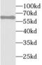 Staufen Double-Stranded RNA Binding Protein 1 antibody, FNab08312, FineTest, Western Blot image 