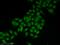 Clock Circadian Regulator antibody, 18094-1-AP, Proteintech Group, Immunofluorescence image 