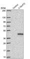 Chromosome 16 Open Reading Frame 72 antibody, PA5-59626, Invitrogen Antibodies, Western Blot image 