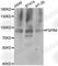 Fibroblast Growth Factor Receptor 4 antibody, A7555, ABclonal Technology, Western Blot image 