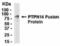 Protein Tyrosine Phosphatase Non-Receptor Type 14 antibody, NB100-75310, Novus Biologicals, Western Blot image 