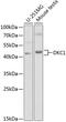 Dyskerin Pseudouridine Synthase 1 antibody, GTX32562, GeneTex, Western Blot image 