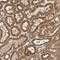 OCRL Inositol Polyphosphate-5-Phosphatase antibody, NBP1-80973, Novus Biologicals, Immunohistochemistry frozen image 