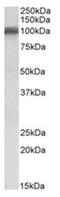 Thioredoxin Domain Containing 11 antibody, AP31107PU-N, Origene, Western Blot image 