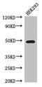 Transcobalamin 2 antibody, LS-C396658, Lifespan Biosciences, Western Blot image 