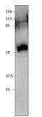 SID1 Transmembrane Family Member 1 antibody, GTX47824, GeneTex, Western Blot image 