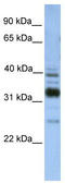 Thioredoxin Related Transmembrane Protein 4 antibody, TA338459, Origene, Western Blot image 