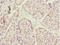 Endoplasmic Reticulum Oxidoreductase 1 Alpha antibody, LS-C675725, Lifespan Biosciences, Immunohistochemistry paraffin image 