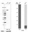 Nuclear Factor Kappa B Subunit 2 antibody, NBP1-87759, Novus Biologicals, Western Blot image 