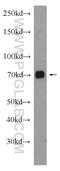 Nuclear Receptor Subfamily 2 Group C Member 2 antibody, 20981-1-AP, Proteintech Group, Western Blot image 