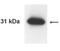 Kallikrein Related Peptidase 13 antibody, GTX30155, GeneTex, Western Blot image 