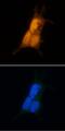 Casein Kinase 2 Alpha 1 antibody, MAB7957, R&D Systems, Immunocytochemistry image 