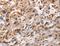 ADAM Like Decysin 1 antibody, LS-C401183, Lifespan Biosciences, Immunohistochemistry paraffin image 