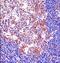 Spi-1 Proto-Oncogene antibody, PA5-35158, Invitrogen Antibodies, Immunohistochemistry paraffin image 
