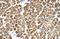 Tropomyosin 2 antibody, NBP1-57612, Novus Biologicals, Immunohistochemistry frozen image 