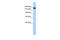 Synaptojanin 1 antibody, 25-622, ProSci, Western Blot image 