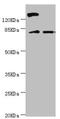 Kinesin Family Member 2B antibody, LS-C675947, Lifespan Biosciences, Western Blot image 