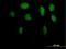 Zinc Finger With KRAB And SCAN Domains 5 antibody, H00023660-B01P, Novus Biologicals, Immunocytochemistry image 