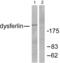 Dysferlin antibody, abx013063, Abbexa, Western Blot image 