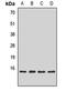 SNAP Associated Protein antibody, LS-C668350, Lifespan Biosciences, Western Blot image 