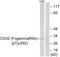 FcRII antibody, LS-C198761, Lifespan Biosciences, Western Blot image 