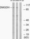 Dimethylglycine Dehydrogenase antibody, LS-C119906, Lifespan Biosciences, Western Blot image 